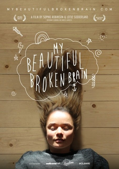 My Beautiful Broken Brain movie poster